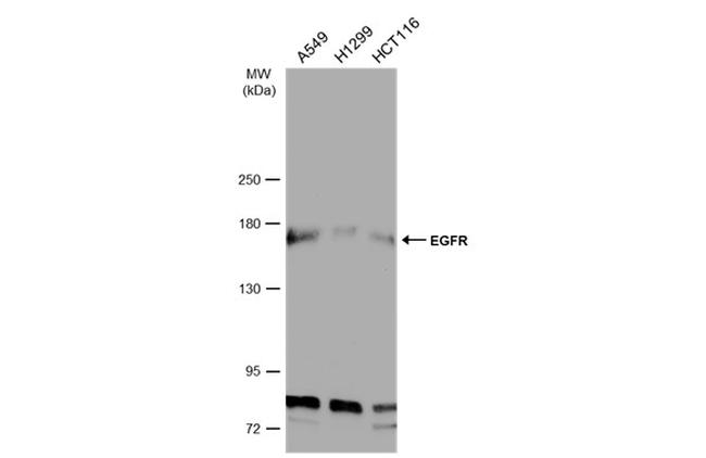 EGFR Antibody in Western Blot (WB)