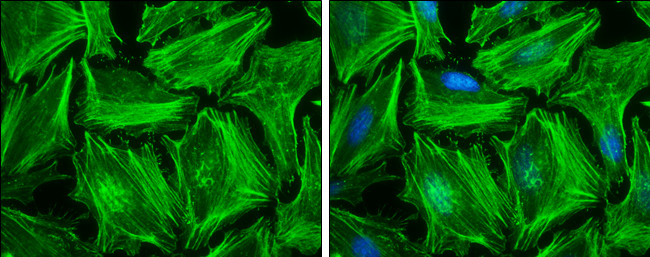 beta Actin Antibody in Immunocytochemistry (ICC/IF)