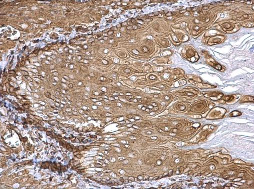 beta Actin Antibody in Immunohistochemistry (Paraffin) (IHC (P))