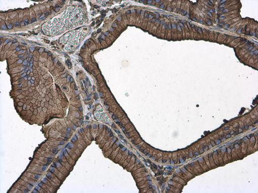 beta Actin Antibody in Immunohistochemistry (Paraffin) (IHC (P))