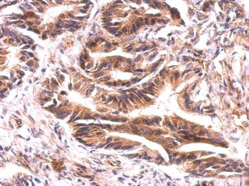 ATG9A Antibody in Immunohistochemistry (Paraffin) (IHC (P))