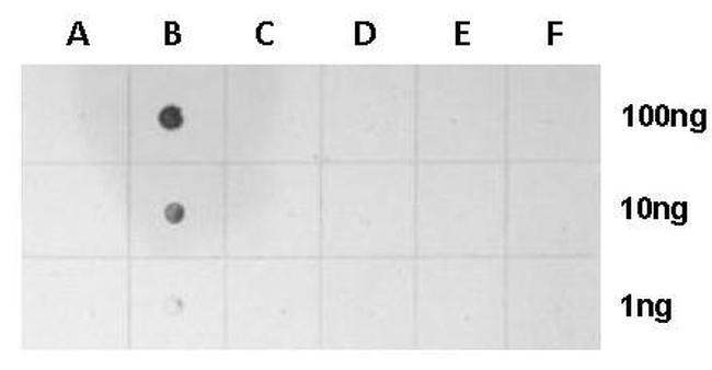 H2AK5ac Antibody in Dot Blot (DB)