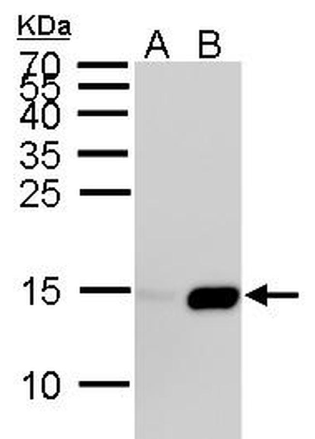 H2AK5ac Antibody in Western Blot (WB)