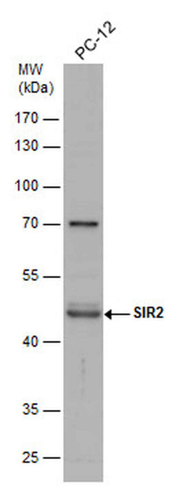 SIRT2 Antibody in Western Blot (WB)