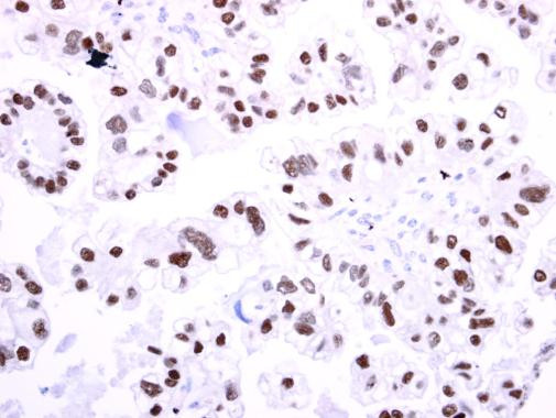 TCF2 Antibody in Immunohistochemistry (Paraffin) (IHC (P))