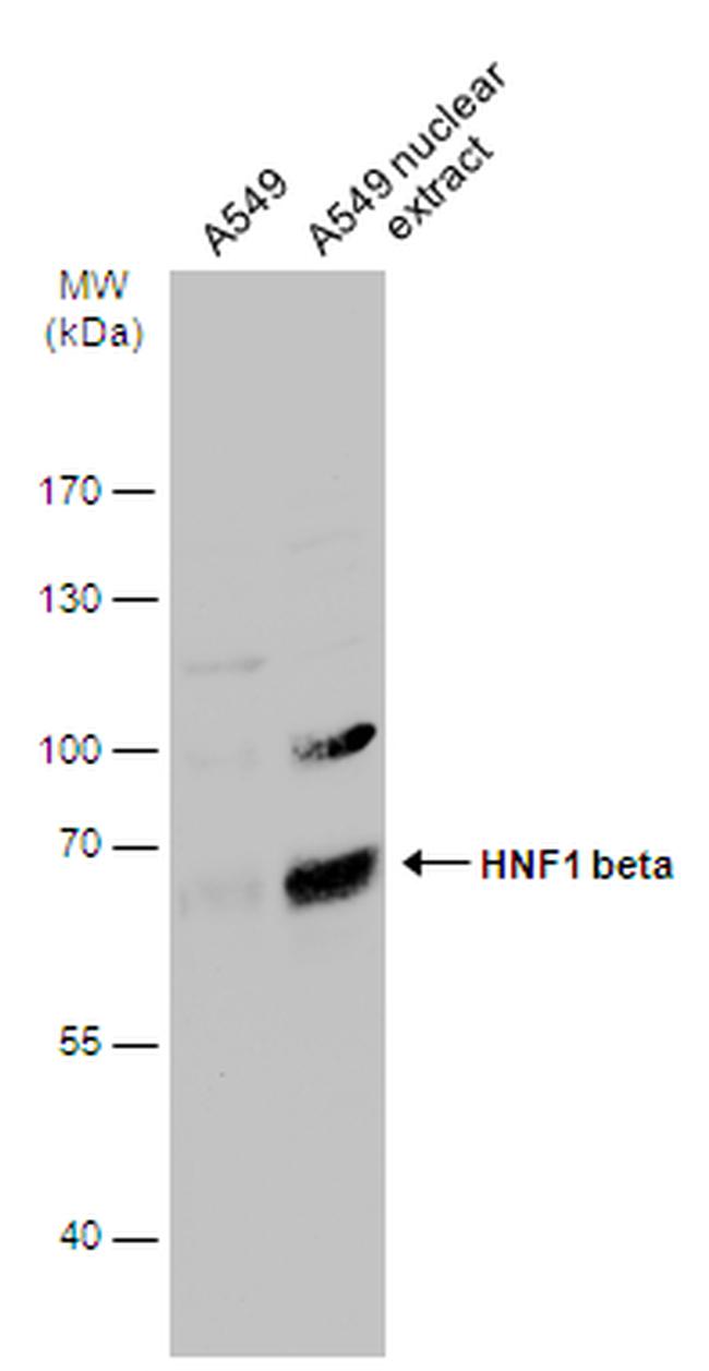 TCF2 Antibody in Western Blot (WB)