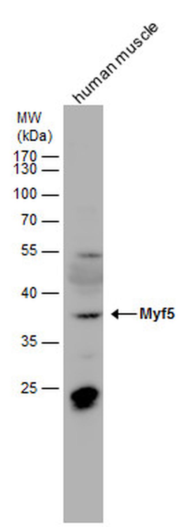 MYF5 Antibody in Western Blot (WB)