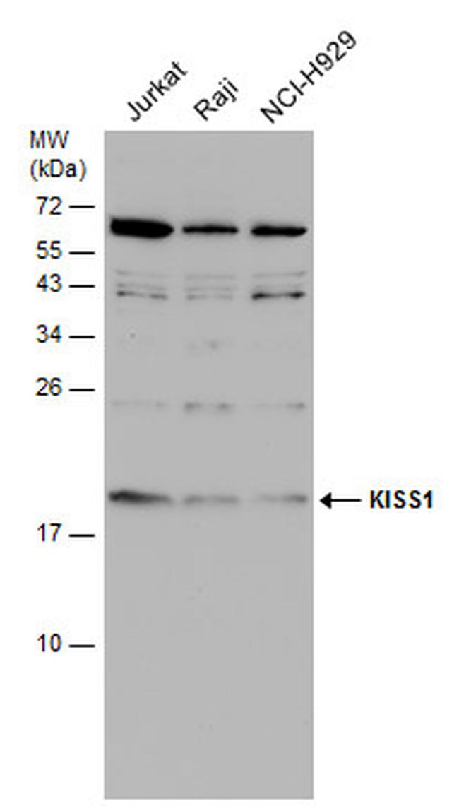 KISS1 Antibody in Western Blot (WB)