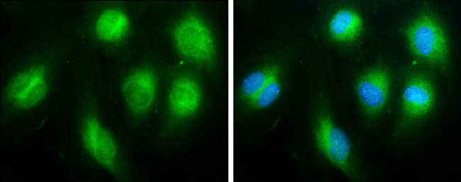 Thrombospondin 1 Antibody in Immunocytochemistry (ICC/IF)