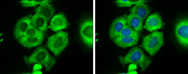 RPS26 Antibody in Immunocytochemistry (ICC/IF)