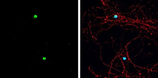 ASCL1 Antibody in Immunocytochemistry (ICC/IF)