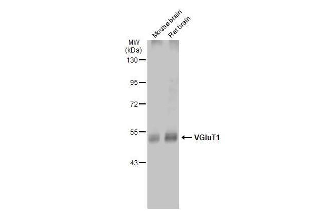 VGLUT1 Polyclonal Antibody (PA5-85764)