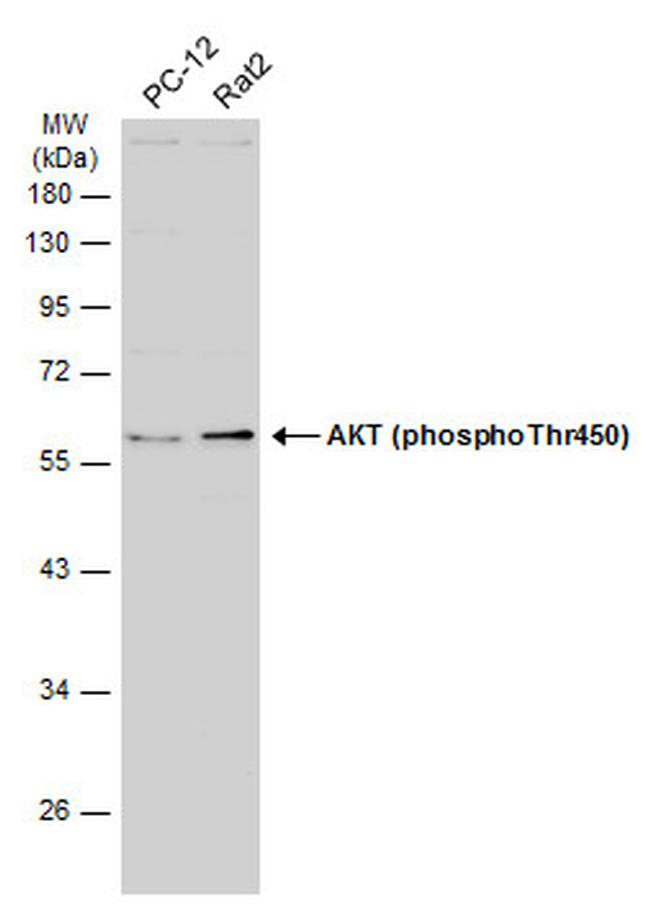 Phospho-AKT1 (Thr450) Antibody in Western Blot (WB)