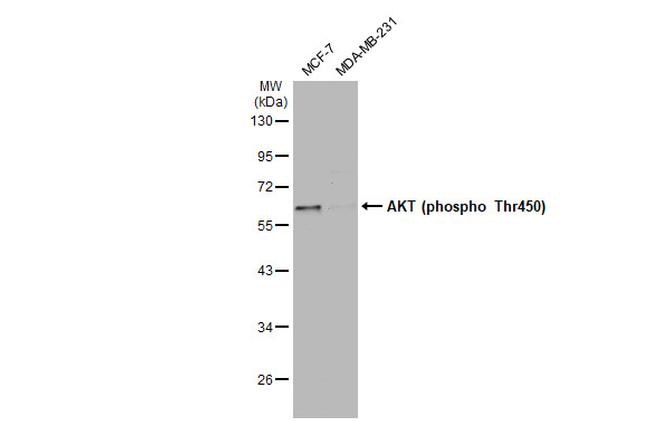 Phospho-AKT1 (Thr450) Antibody in Western Blot (WB)