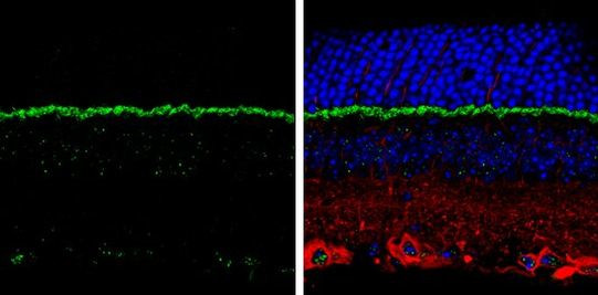 PSD-95 Antibody in Immunohistochemistry (Paraffin) (IHC (P))