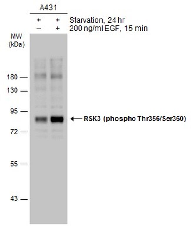 Phospho-RSK3 (Thr356, Ser360) Antibody in Western Blot (WB)