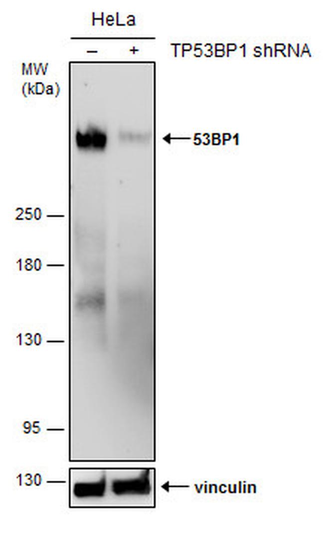 53BP1 Antibody in Western Blot (WB)