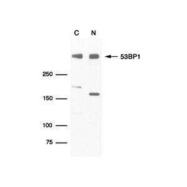 53BP1 Antibody in Western Blot (WB)