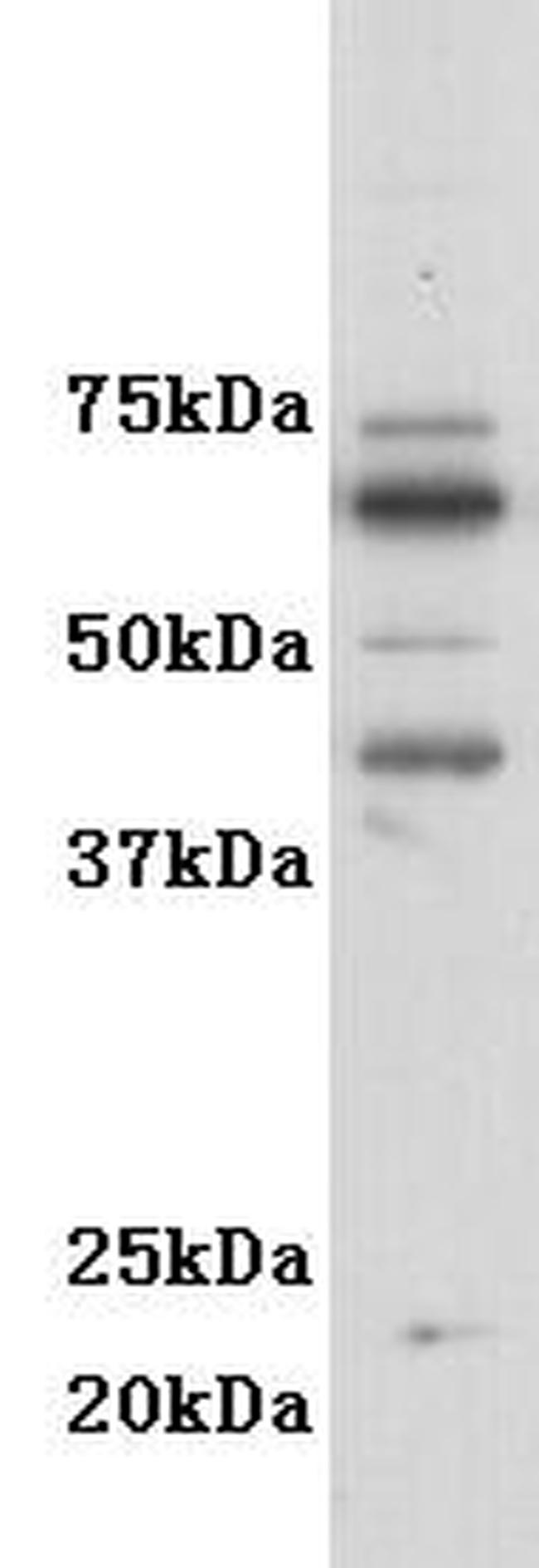 CD116 Antibody in Western Blot (WB)
