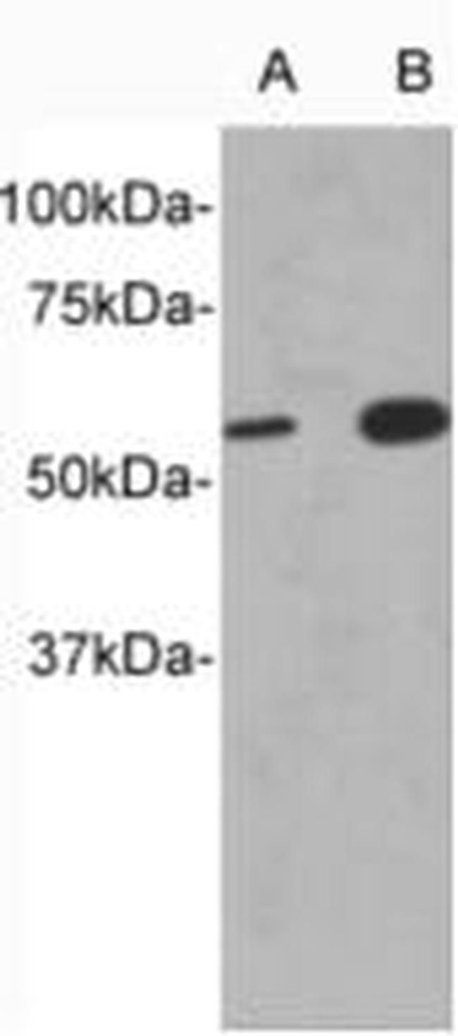 CD213a1 (IL-13Ra1) Antibody in Western Blot (WB)