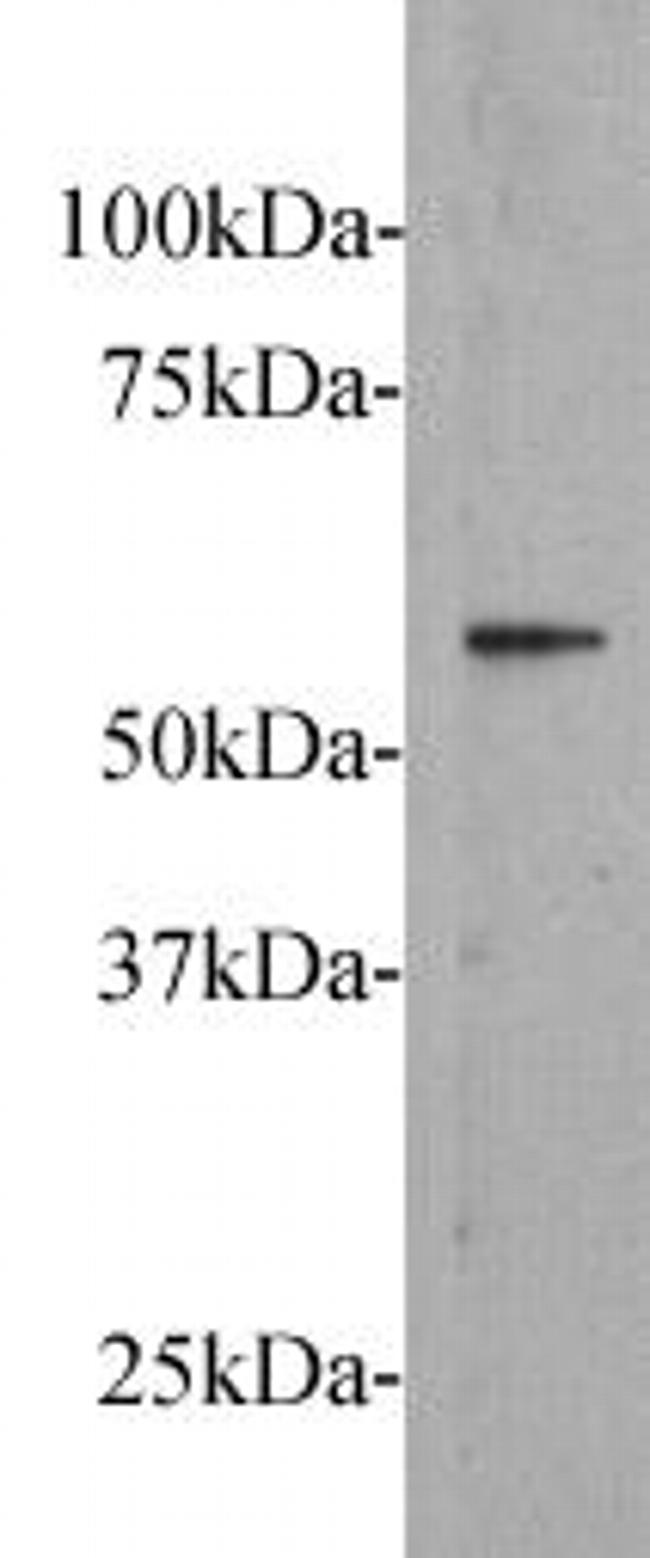 FZD5 Antibody in Western Blot (WB)