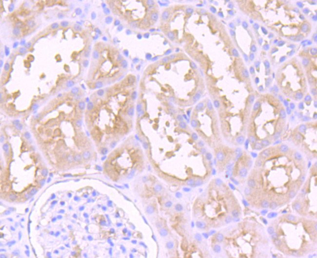 Dysferlin Antibody in Immunohistochemistry (Paraffin) (IHC (P))