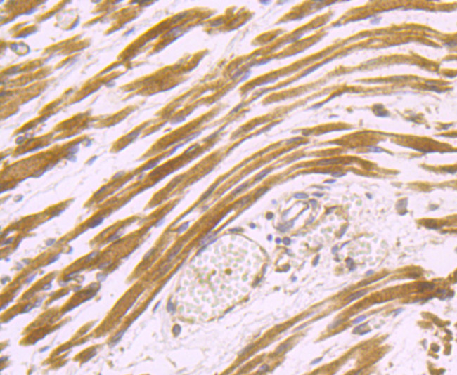 Dysferlin Antibody in Immunohistochemistry (Paraffin) (IHC (P))