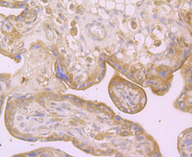 Dysferlin Antibody in Immunohistochemistry (Paraffin) (IHC (P))