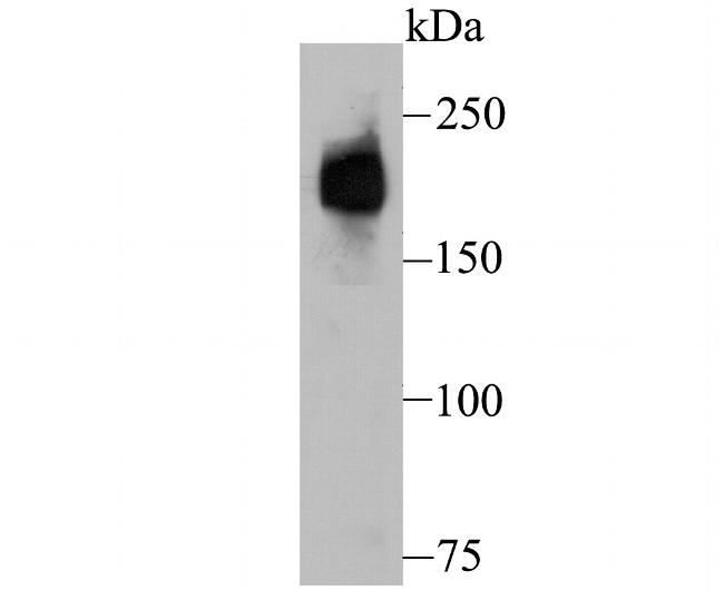 Dysferlin Antibody in Western Blot (WB)