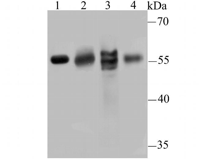 IL17RB Antibody in Western Blot (WB)