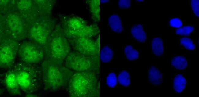 ATF6 Antibody in Immunocytochemistry (ICC/IF)