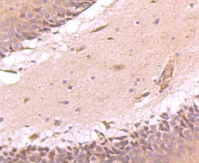 ATF6 Antibody in Immunohistochemistry (Paraffin) (IHC (P))