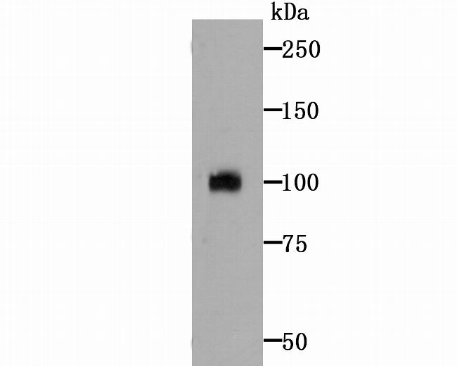 ATF6 Antibody in Western Blot (WB)