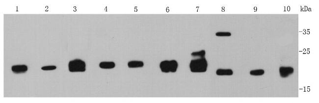 MGMT Antibody in Western Blot (WB)