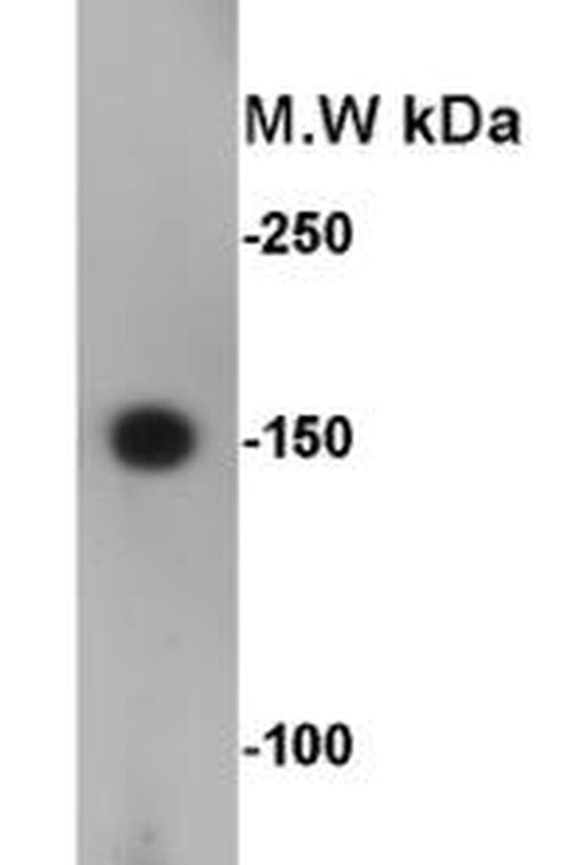 CD56 (NCAM) Antibody in Western Blot (WB)