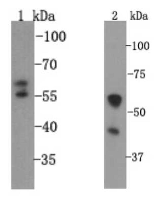 SLC18A1 Antibody in Western Blot (WB)