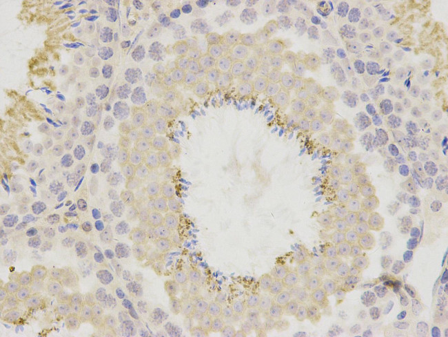 BNC1 Antibody in Immunohistochemistry (Paraffin) (IHC (P))