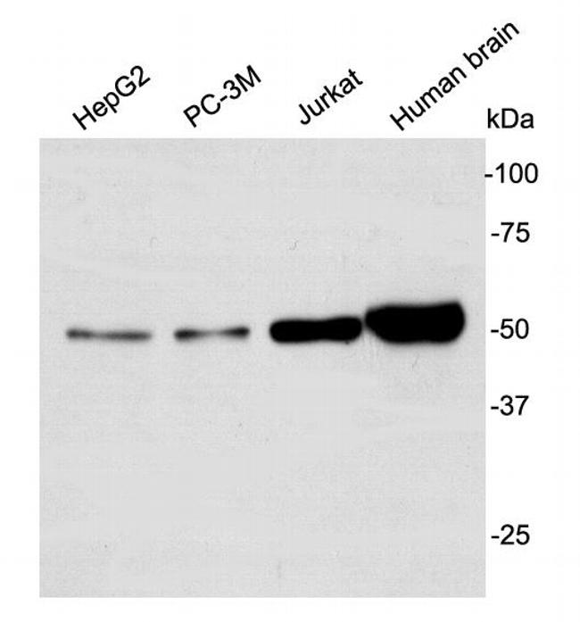 GSK3 alpha Antibody in Western Blot (WB)