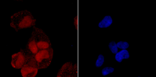 CUG-BP2 Antibody in Immunocytochemistry (ICC/IF)