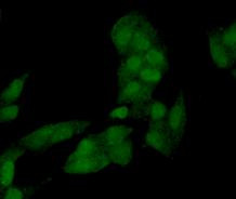 PP2A alpha/beta Antibody in Immunocytochemistry (ICC/IF)