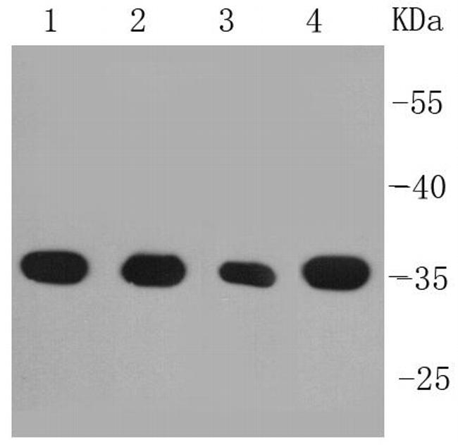 PP2A alpha/beta Antibody in Western Blot (WB)