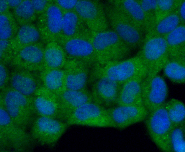 Filamin A Antibody in Immunocytochemistry (ICC/IF)