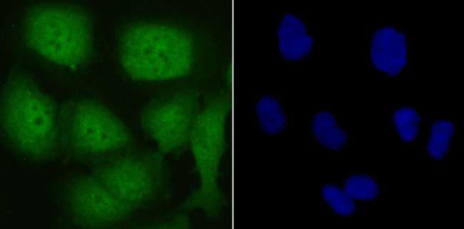 UBA3 Antibody in Immunocytochemistry (ICC/IF)