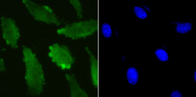 UBA3 Antibody in Immunocytochemistry (ICC/IF)