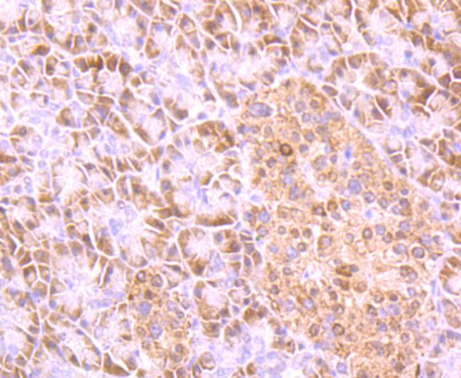 UBA3 Antibody in Immunohistochemistry (Paraffin) (IHC (P))