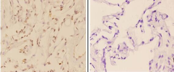 c-Abl Antibody in Immunohistochemistry (Paraffin) (IHC (P))