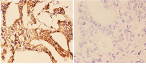 14-3-3 zeta Antibody in Immunohistochemistry (Paraffin) (IHC (P))