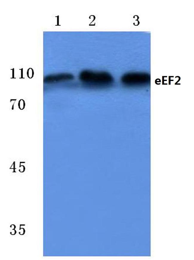 EEF2 Antibody in Western Blot (WB)