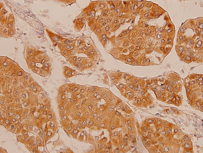 FGFR2 Antibody in Immunohistochemistry (Paraffin) (IHC (P))