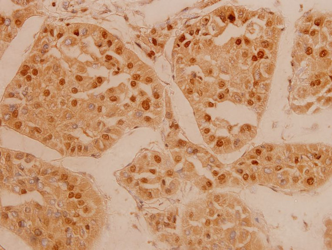 FGFR3 Antibody in Immunohistochemistry (Paraffin) (IHC (P))